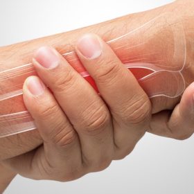 Tình trạng đau cổ tay phải nhưng không sưng có thể là bệnh gì