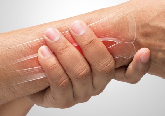 Tình trạng đau cổ tay phải nhưng không sưng có thể là bệnh gì