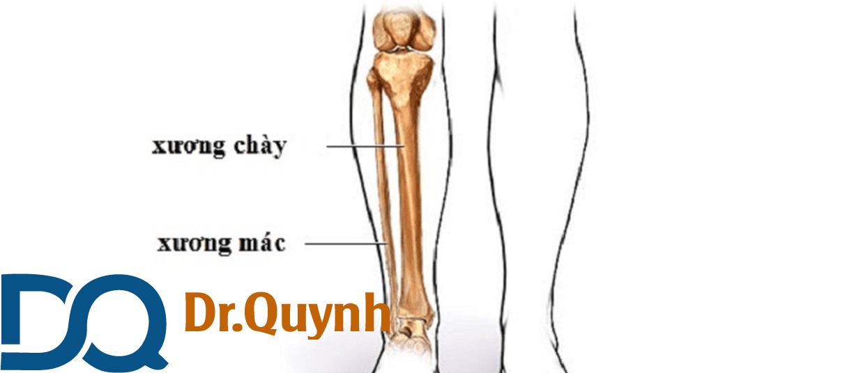 Rạn xương mác cẳng chân là một dạng gãy xương phổ biến như thế nào?
