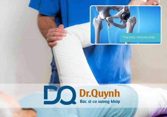 Trong những năm gần đây, nhu cầu tìm hiểu về chi phí thay khớp háng ngày càng tăng, đặc biệt ở nhóm người cao tuổi mắc bệnh thoái hóa khớp, hoại tử chỏm xương đùi hay chấn thương nặng vùng háng.