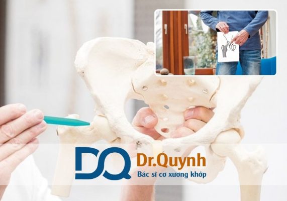 Chi phí thay khớp háng cho người già là một trong những vấn đề được nhiều gia đình quan tâm khi có người thân lớn tuổi mắc các bệnh lý về khớp háng