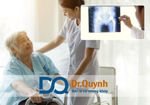 Vì sao chi phí thay khớp háng khác nhau giữa các bệnh viện? Trong những năm gần đây, nhu cầu thay khớp háng ở người cao tuổi tăng nhanh do dân số già hóa và tỷ lệ bệnh lý về khớp ngày càng phổ biến.