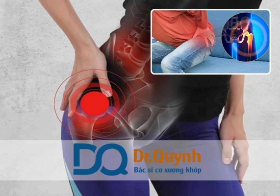 Vì sao chi phí thay khớp háng cao? Chi phí thay khớp háng là một trong những vấn đề quan tâm hàng đầu của người bệnh và gia đình khi cần can thiệp phẫu thuật khớp háng.