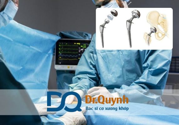 Chi phí thay khớp háng cho bệnh nhân trẻ tuổi so với người cao tuổi luôn là một chủ đề được quan tâm bởi mỗi nhóm tuổi có nhu cầu và đặc thù điều trị khác nhau.