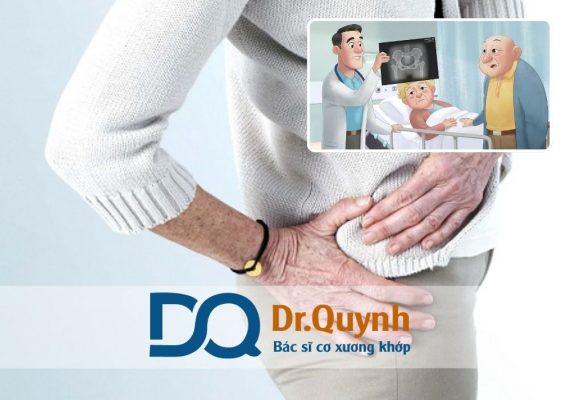 Chi phí thay khớp háng có BHYT Chi phí thay khớp háng có bảo hiểm y tế là mối quan tâm lớn đối với nhiều người bệnh và gia đình đang đối mặt với các vấn đề nghiêm trọng về vận động, thoái hóa hay hoại tử khớp háng.