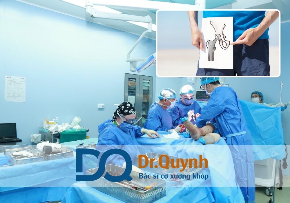 Theo CHUYÊN GIA, BÁC SĨ CKI LÊ VĂN QUỲNH (https://www.bslevanquynh.vn/), điều quan trọng nhất không phải là chọn bệnh viện công hay tư, mà là chọn đúng thời điểm mổ, loại khớp phù hợp và bác sĩ có kinh nghiệm.