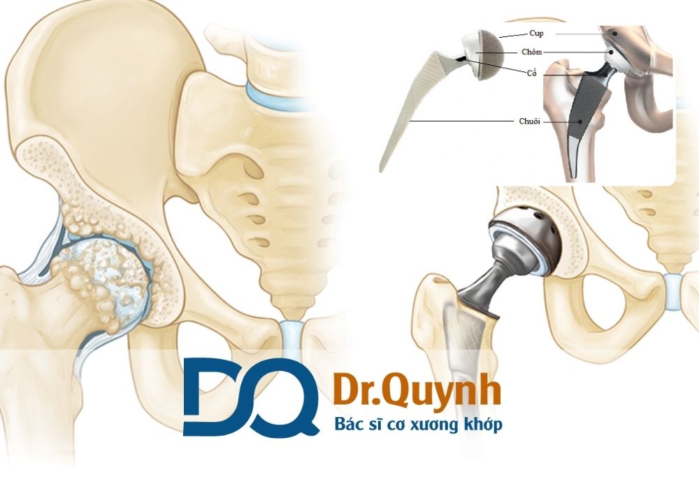 Bạn có thể tham khảo gói tại phòng khám của CHUYÊN GIA, BÁC SĨ CKI LÊ VĂN QUỲNH – nơi áp dụng linh hoạt các hình thức thanh toán, hỗ trợ từng trường hợp cụ thể.