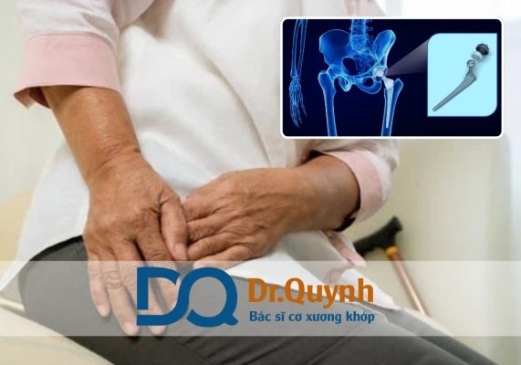 Tư vấn với chuyên gia trước khi phẫu thuật, ví dụ như BÁC SĨ CKI LÊ VĂN QUỲNH, để không phát sinh chi phí ngoài dự tính.
