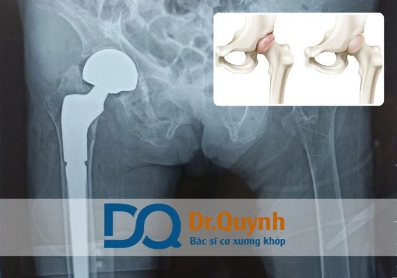 Đừng chỉ nhìn vào con số đầu tiên – hãy tính đến giá trị lâu dài, sức khỏe và sự an tâm trong suốt quá trình điều trị.