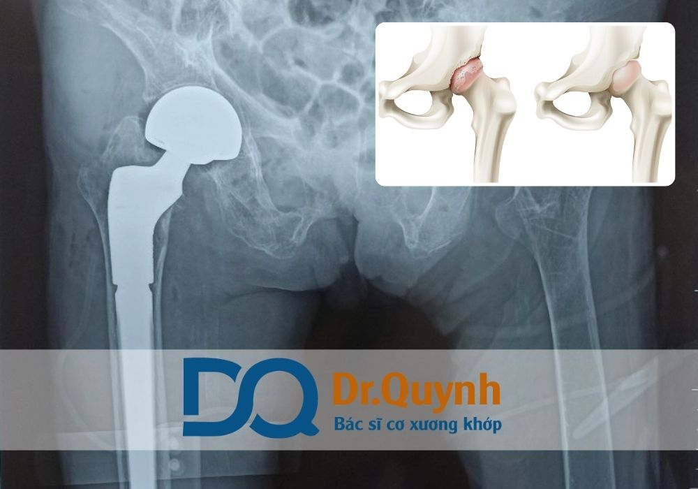 Đừng chỉ nhìn vào con số đầu tiên – hãy tính đến giá trị lâu dài, sức khỏe và sự an tâm trong suốt quá trình điều trị.
