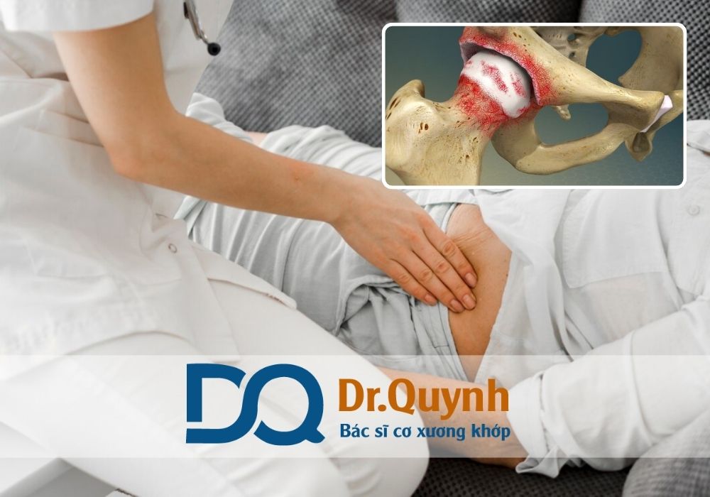 Việc thay khớp háng sớm là lựa chọn sáng suốt giúp cải thiện chất lượng sống, đặc biệt với người lớn tuổi và những người bị tổn thương khớp nặng.
