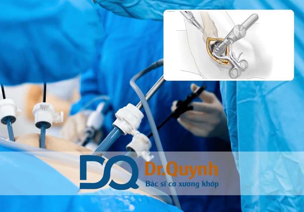 Hãy cân nhắc kỹ lưỡng và đừng ngần ngại liên hệ để được hỗ trợ từ chuyên gia y tế uy tín!