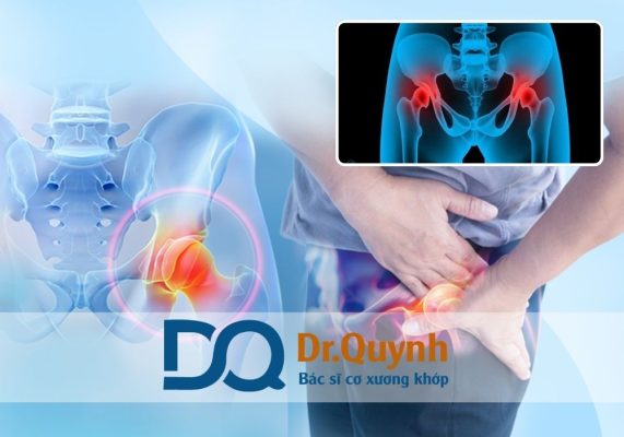 Để có thông tin cụ thể về chi phí thay khớp háng mới nhất, bạn có thể tham khảo tại Sức khoẻ đời sống hoặc liên hệ trực tiếp với chuyên gia.