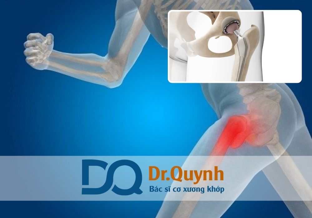 Tuy nhiên, bạn nên trao đổi cụ thể với CHUYÊN GIA, BÁC SĨ CKI LÊ VĂN QUỲNH để được tư vấn lựa chọn cơ sở phù hợp nhất với tình trạng và điều kiện tài chính của mình.