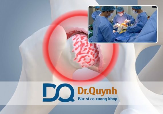 Quy trình và chi phí thay khớp háng cần biết Thay khớp háng không chỉ là giải pháp tối ưu giúp người bệnh phục hồi khả năng vận động mà còn nâng cao chất lượng cuộc sống lâu dài.