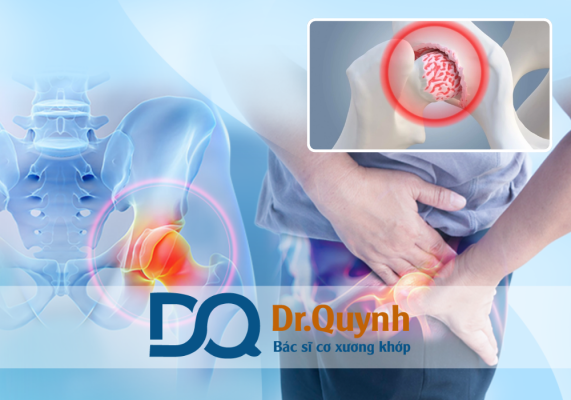 Các gói dịch vụ thay khớp háng và mức giá tương ứng Mỗi gói dịch vụ đều có ưu – nhược điểm riêng, và nếu được tư vấn bởi đội ngũ chuyên môn như CHUYÊN GIA, BÁC SĨ CKI LÊ VĂN QUỲNH, bệnh nhân sẽ có quyết định chính xác và an tâm hơn trong quá trình phục hồi sức khỏe.