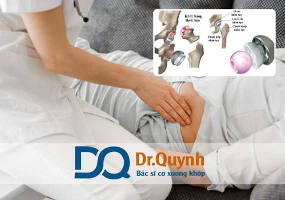 Chi phí thay khớp háng có BHYT Việc đồng hành cùng một bác sĩ chuyên môn cao và cơ sở y tế uy tín như CHUYÊN GIA, BÁC SĨ CKI LÊ VĂN QUỲNH sẽ giúp người bệnh yên tâm hơn trong hành trình phục hồi sức khỏe và vận động.