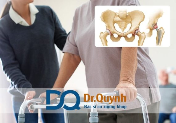 Thay khớp háng cho người cao tuổi Nếu bạn đang cân nhắc phẫu thuật thay khớp háng cho ông bà, cha mẹ, hãy đến gặp CHUYÊN GIA, BÁC SĨ CKI LÊ VĂN QUỲNH để được tư vấn kỹ lưỡng và đưa ra giải pháp phù hợp nhất.