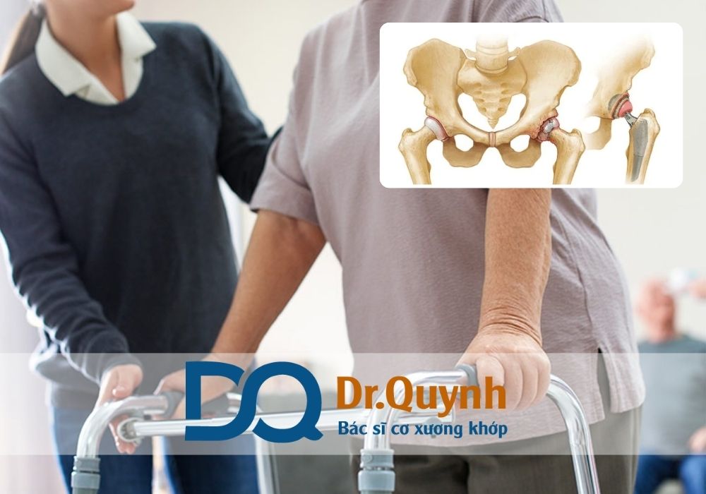 Nếu bạn đang cân nhắc phẫu thuật thay khớp háng cho ông bà, cha mẹ, hãy đến gặp CHUYÊN GIA, BÁC SĨ CKI LÊ VĂN QUỲNH để được tư vấn kỹ lưỡng và đưa ra giải pháp phù hợp nhất.