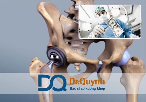 So sánh chi phí thay khớp háng: Việt Nam vs quốc tế Lựa chọn thay khớp háng tại Việt Nam không chỉ là giải pháp kinh tế mà còn là cơ hội phục hồi chức năng nhanh chóng, an toàn và hiệu quả – đặc biệt khi được thực hiện bởi các chuyên gia như BÁC SĨ CKI LÊ VĂN QUỲNH.
