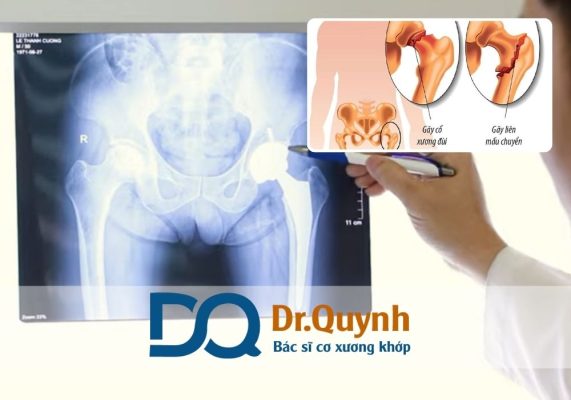 Đừng ngần ngại liên hệ các chuyên gia như BÁC SĨ CKI LÊ VĂN QUỲNH để được tư vấn đúng hướng, tiết kiệm và an toàn.