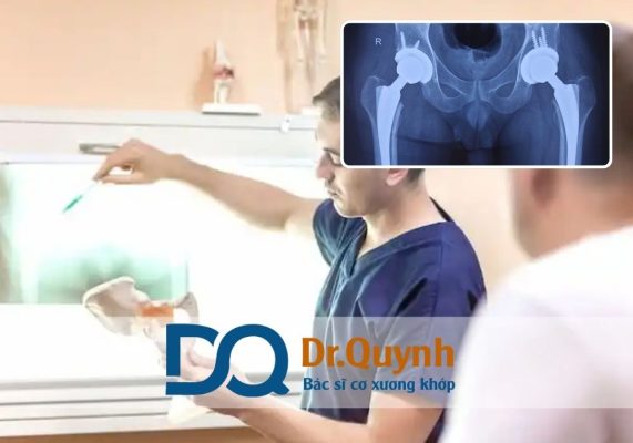 Chi phí thay khớp háng và bảo hiểm: Đảm bảo chi phí hợp lý cho người bệnh Hãy bắt đầu từ việc lựa chọn đúng tuyến, chọn loại khớp phù hợp, kết hợp điều trị tại cơ sở có BHYT và phục hồi tại trung tâm uy tín như của CHUYÊN GIA, BÁC SĨ CKI LÊ VĂN QUỲNH để vừa đảm bảo hiệu quả, vừa tối ưu ngân sách.
