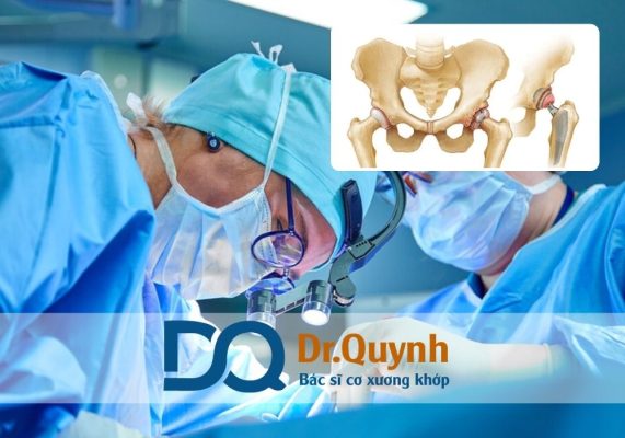 Thay khớp háng: Chi phí và các dịch vụ đi kèm cần biết là vấn đề mà hầu hết bệnh nhân và người nhà quan tâm khi đứng trước quyết định phẫu thuật.