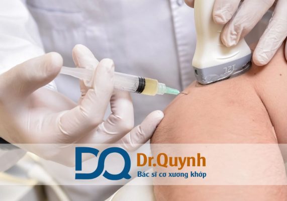 Tiêm huyết tương giàu tiểu cầu (PRP – Platelet Rich Plasma) hiện nay được xem là phương pháp sinh học tiên tiến trong điều trị đau khớp gối do thoái hóa, chấn thương thể thao hay viêm khớp