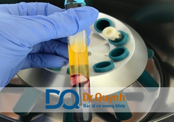Tiêm huyết tương giàu tiểu cầu (PRP – Platelet Rich Plasma) hiện đang trở thành một trong những bước tiến nổi bật trong y học tái tạo, mang lại hy vọng điều trị cho hàng ngàn bệnh nhân gặp vấn đề về cơ xương khớp, da liễu, tóc và phục hồi sau chấn thương.