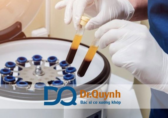 Ưu điểm và hạn chế của tiêm huyết tương giàu tiểu cầu Tiêm huyết tương giàu tiểu cầu (Platelet Rich Plasma – PRP) là một trong những thành tựu nổi bật của y học tái tạo hiện đại.