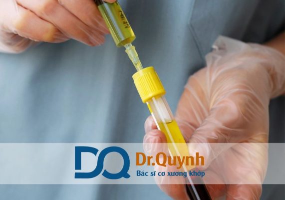 Tiêm huyết tương giàu tiểu cầu trong điều trị đau khớp gối là giải pháp sinh học an toàn, ít xâm lấn, mang lại hiệu quả lâu dài