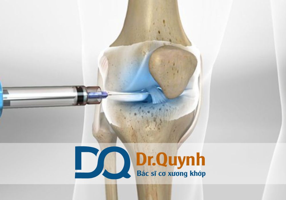 PRP là bước tiến mới trong điều trị, giúp bệnh nhân giảm đau, tăng vận động, cải thiện chất lượng cuộc sống mà không cần phẫu thuật sớm.