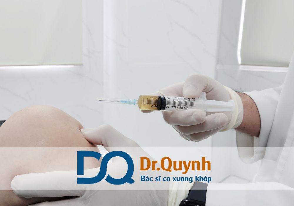 Tiêm huyết tương giàu tiểu cầu (PRP) hiện nay được xem là một trong những phương pháp điều trị tiên tiến, hiệu quả và an toàn trong lĩnh vực cơ xương khớp, thẩm mỹ da và phục hồi chấn thương thể thao.