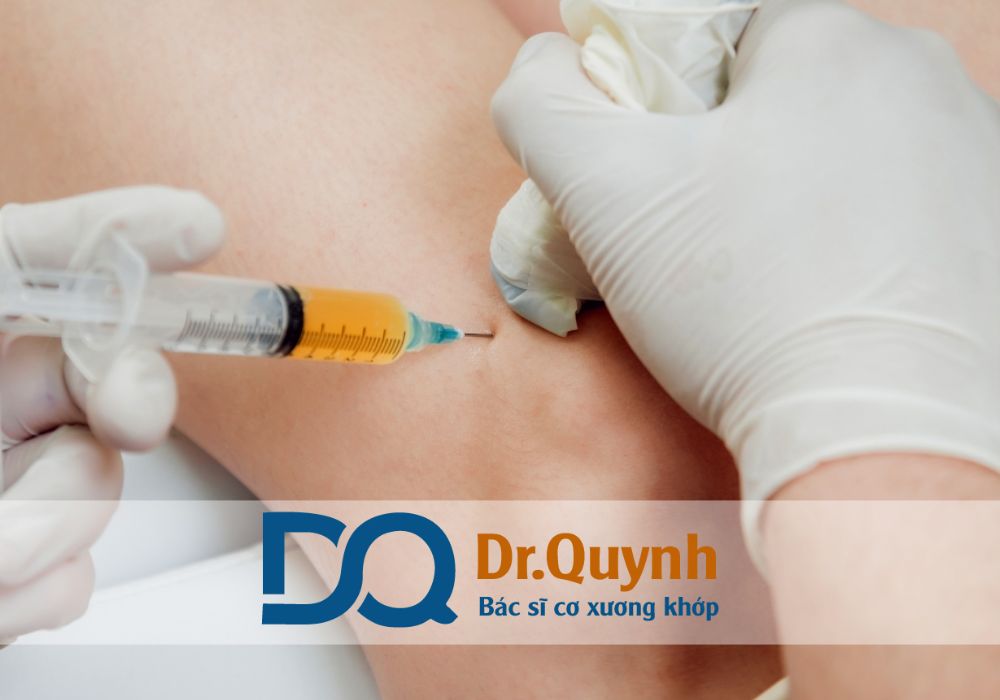 Tiêm huyết tương giàu tiểu cầu (PRP – Platelet Rich Plasma) ngày càng được ứng dụng rộng rãi trong điều trị thoái hóa khớp nhờ khả năng tái tạo sụn, giảm đau, cải thiện vận động và làm chậm tiến triển bệnh.