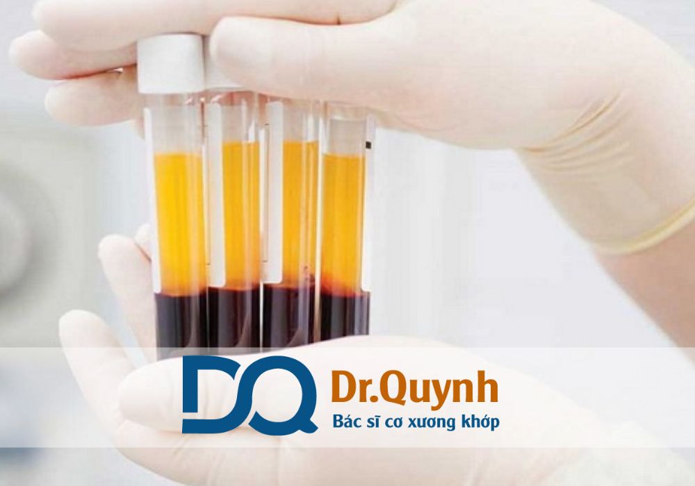 Thực hiện bởi CHUYÊN GIA, BÁC SĨ CKI LÊ VĂN QUỲNH, bệnh nhân hoàn toàn yên tâm về kết quả bền vững, an toàn.