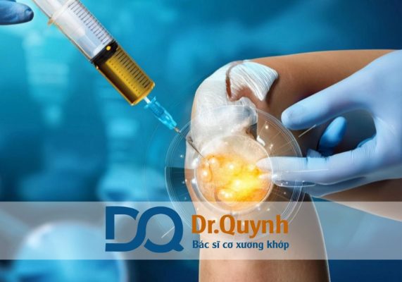 Ứng dụng tiêm huyết tương giàu tiểu cầu trong thoái hóa khớp Ứng dụng tiêm huyết tương giàu tiểu cầu trong thoái hóa khớp là bước tiến quan trọng trong y học tái tạo.