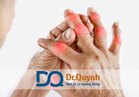 Review khám Bác sĩ xương khớp giỏi Quận 7 Bệnh lý cơ xương khớp vốn dai dẳng, dễ tái phát, do đó cần sự can thiệp của bác sĩ có kiến thức chuyên sâu, kinh nghiệm dày dạn và đặc biệt là sự tận tâm với bệnh nhân.