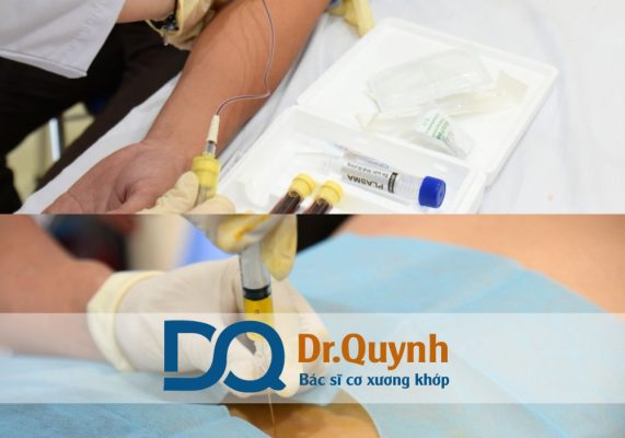 TOP5 Địa chỉ tiêm huyết tương giàu tiểu cầu uy tín tại HCM Địa chỉ tiêm huyết tương giàu tiểu cầu uy tín tại TPHCM là vấn đề được rất nhiều người quan tâm khi tìm kiếm giải pháp điều trị các bệnh lý cơ xương khớp, chấn thương thể thao, thoái hóa khớp hoặc phục hồi sau phẫu thuật.