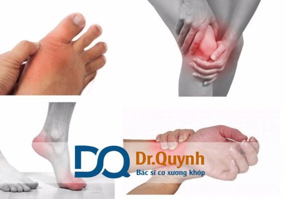Phòng khám xương khớp gần đây - Quận 7 Phòng khám xương khớp gần đây – Quận 7 là giải pháp tối ưu cho những ai đang gặp vấn đề về xương khớp, gân cơ, dây chằng hay chấn thương thể thao