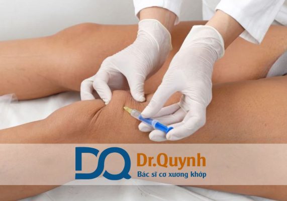 Chi phí tiêm chất nhờn khớp gối là một trong những vấn đề được nhiều bệnh nhân thoái hóa khớp quan tâm, đặc biệt là những người đang tìm kiếm phương pháp giảm đau
