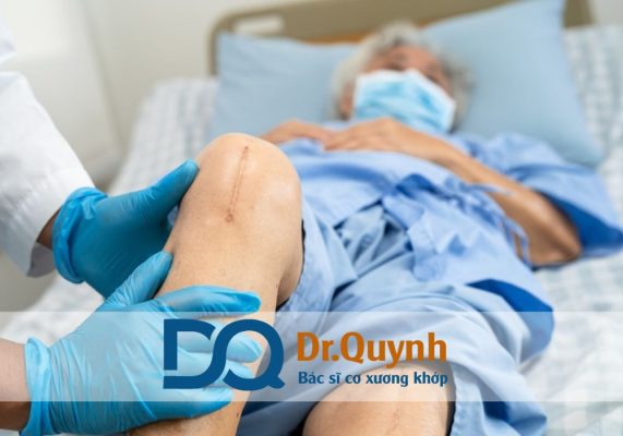 Review thay khớp gối bệnh viện chợ rẫy Chợ Rẫy có bề dày kinh nghiệm trong phẫu thuật thay khớp gối với hàng trăm ca mổ mỗi năm.