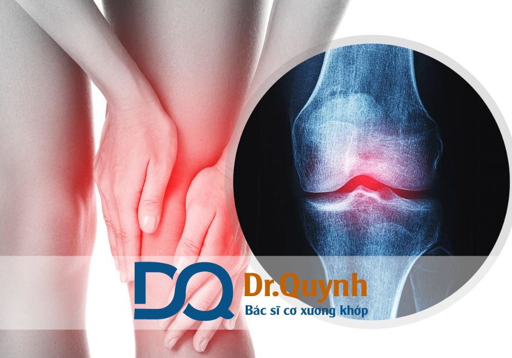 Với đội ngũ Bác sĩ xương khớp giỏi, đặc biệt là CHUYÊN GIA, BÁC SĨ CKI LÊ VĂN QUỲNH , phòng khám mang lại dịch vụ y tế chất lượng cao, tận tâm và linh hoạt về thời gian.