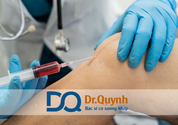 Hiệu quả tiêm huyết tương giàu tiểu cầu trong điều trị viêm gân Nếu bạn đang gặp tình trạng viêm gân kéo dài, hãy tham khảo ý kiến từ CHUYÊN GIA, BÁC SĨ CKI LÊ VĂN QUỲNH để được tư vấn giải pháp điều trị hiệu quả và an toàn nhất.