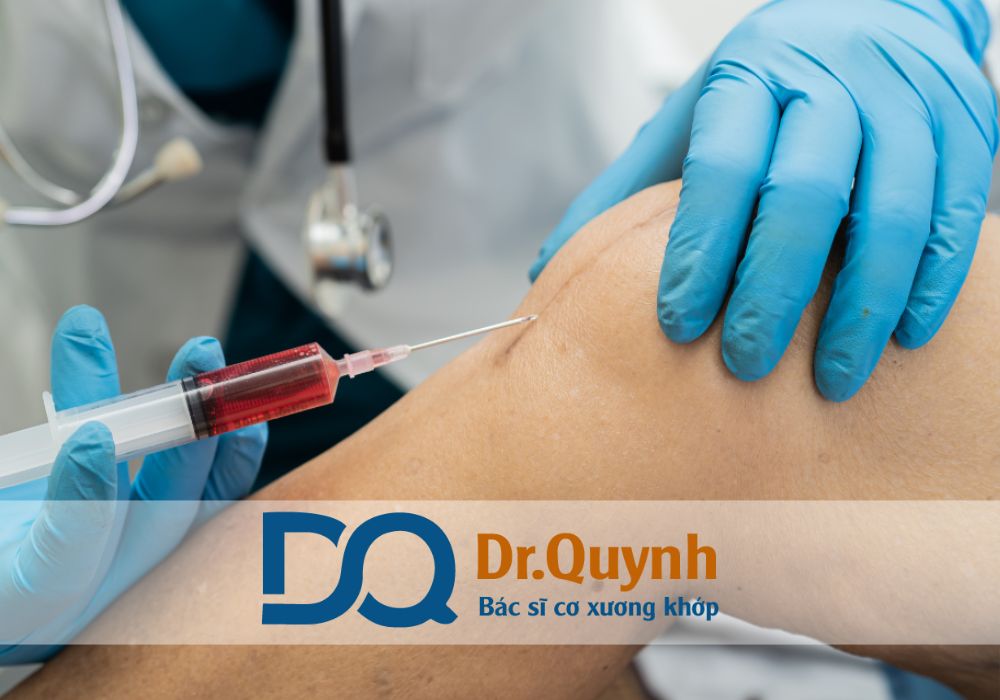 Nếu bạn đang gặp tình trạng viêm gân kéo dài, hãy tham khảo ý kiến từ CHUYÊN GIA, BÁC SĨ CKI LÊ VĂN QUỲNH để được tư vấn giải pháp điều trị hiệu quả và an toàn nhất.
