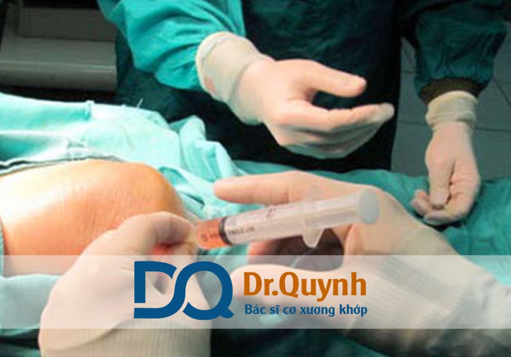 Trong khi tiêm huyết tương giàu tiểu cầu tại TPHCM đang được ứng dụng rộng rãi vì tính an toàn, hiệu quả, thì liệu pháp tế bào gốc lại mang đến hy vọng tái tạo toàn diện cho những trường hợp nặng.
