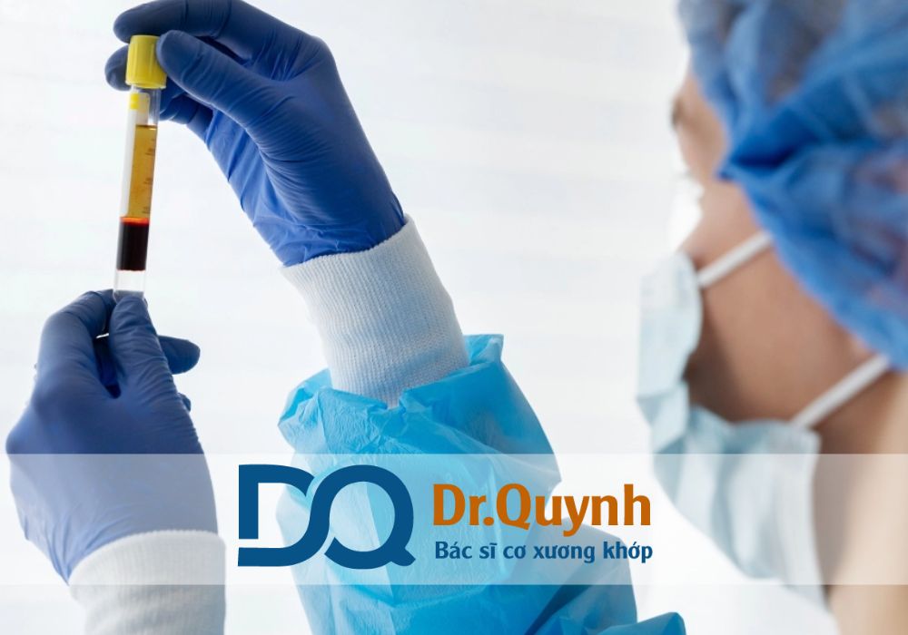 PRP không phải là “thuốc tiên” có thể chữa bách bệnh. Nó phù hợp với một số tình huống cụ thể, đặc biệt trong xương khớp và chấn thương thể thao
