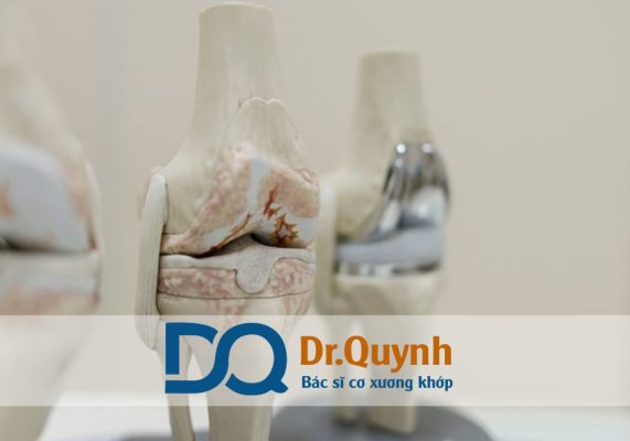 Chi phí thay khớp gối với bác sĩ chuyên khoa giỏi tại Bệnh viện Nam Sài Gòn Với lợi thế là bệnh viện tư nhân hiện đại, đội ngũ bác sĩ chấn thương chỉnh hình chuyên khoa giỏi, cùng dịch vụ chăm sóc chuẩn quốc tế