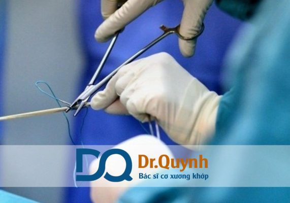 Review chi phí mổ dây chằng chéo trước ở bệnh viện 115 Bệnh viện Nhân Dân 115 nổi bật ở chuyên khoa chấn thương chỉnh hình, mang đến dịch vụ phẫu thuật hiệu quả, an toàn và chi phí hợp lý.