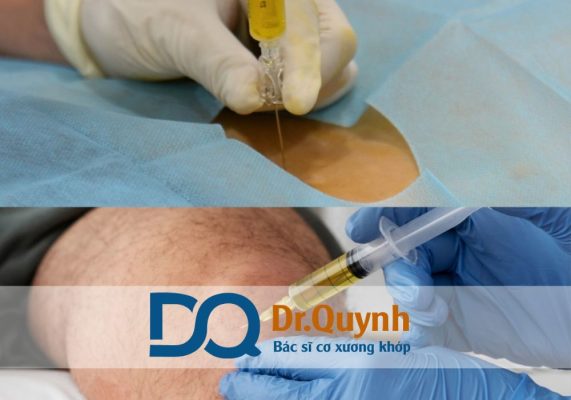TOP5 Địa chỉ tiêm huyết tương giàu tiểu cầu uy tín tại HCM Nếu bạn vẫn băn khoăn, hãy liên hệ ngay với CHUYÊN GIA, BÁC SĨ CKI LÊ VĂN QUỲNH để được tư vấn giải pháp tối ưu cho tình trạng sức khỏe của mình.