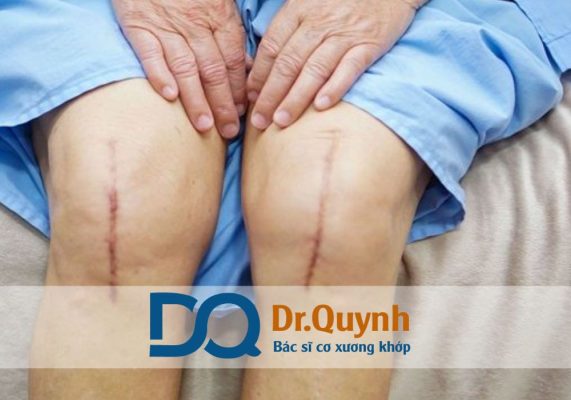 Review thay khớp gối Bệnh viện Chấn Thương Chỉnh Hình TP.HCM là một chủ đề nhận được sự quan tâm đặc biệt trong những năm gần đây